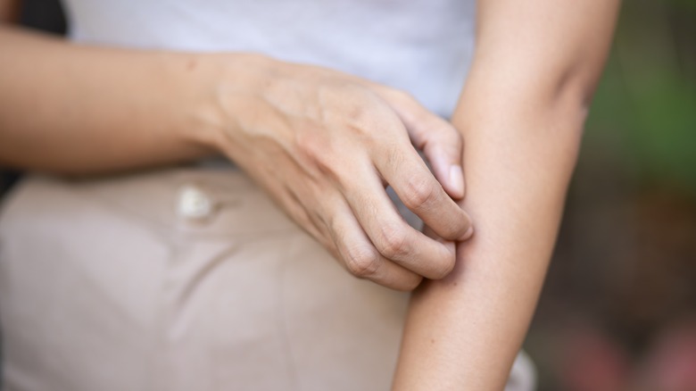 woman scratching her arm
