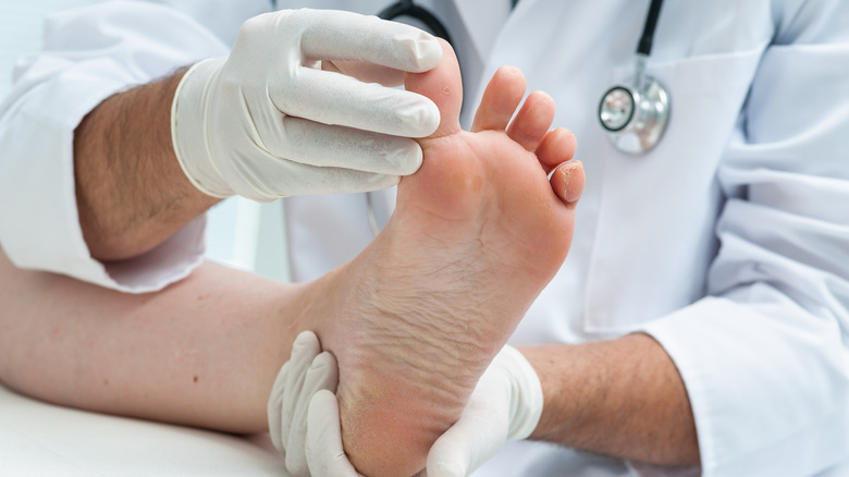 doctor examining athlete's foot