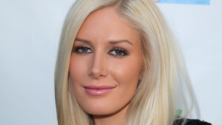 Heidi Montag plastic surgery