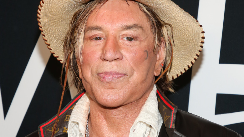 Mickey Rourke plastic surgery