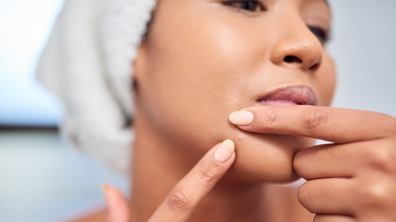 woman picking at chin pimple