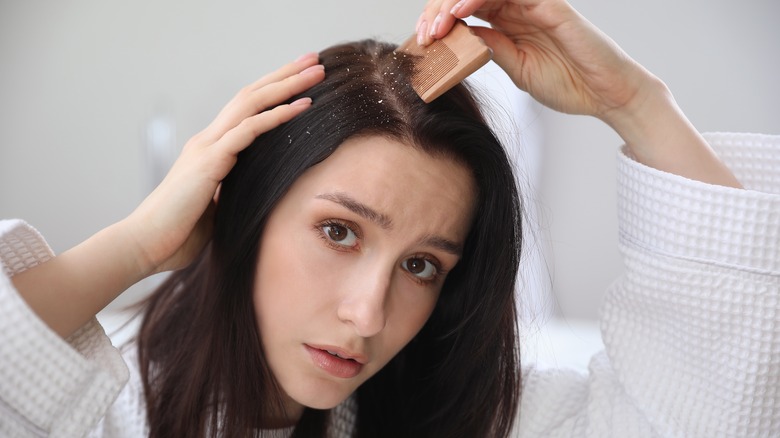 woman looking at her dandruff