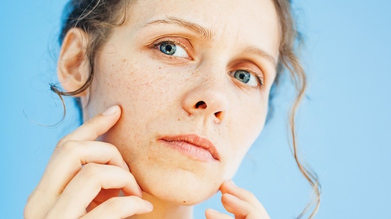 Woman with pale yellow skin