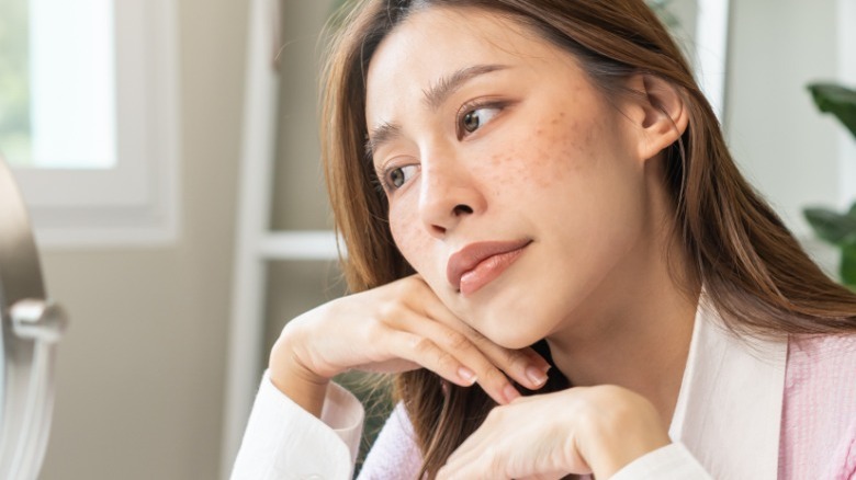 Woman with sun spots