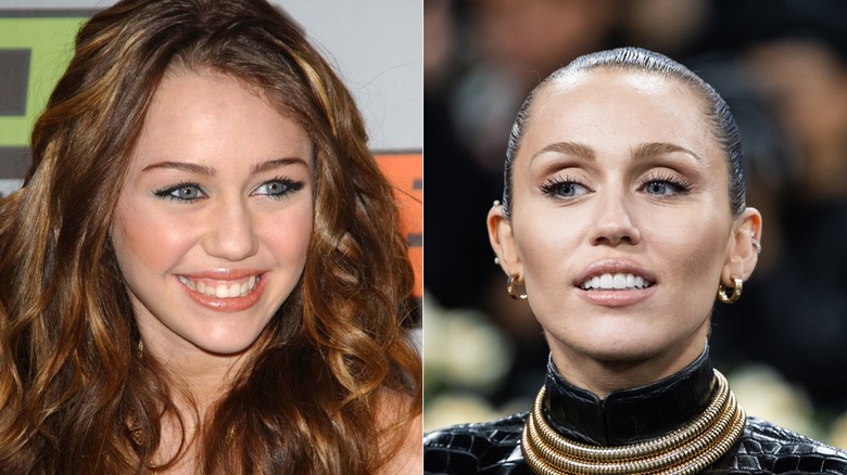 Young Miley Cyrus' teeth before and after her veneers