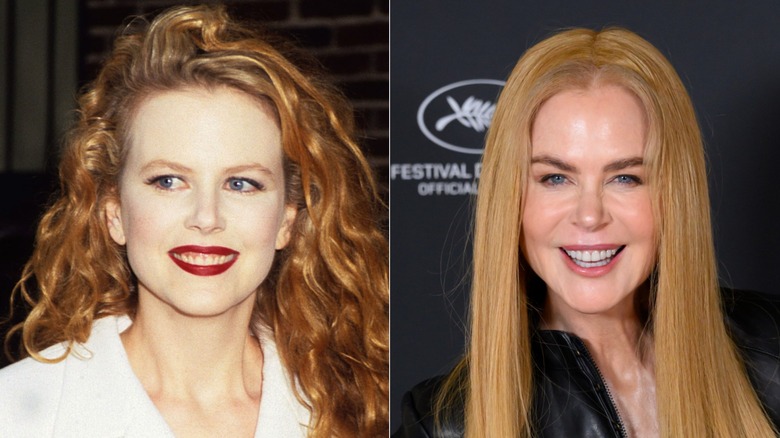 Nicole Kidman's teeth before - which show lots of gum - and after getting veneers