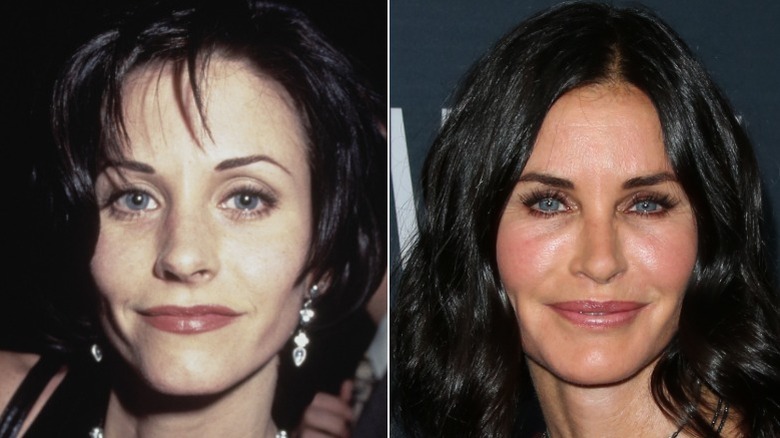 Courteney Cox in 1994 and 2015 after getting lip and face filler