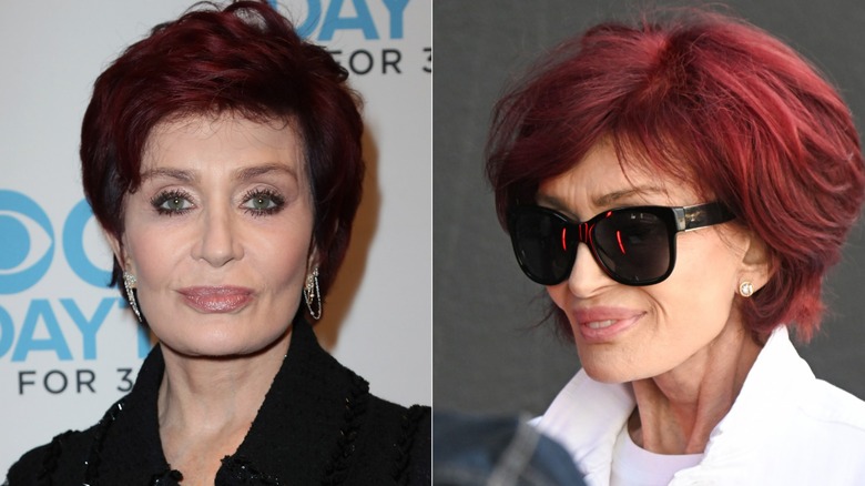 Side-by-side photos showing Sharon Osbourne's weight loss around her neck