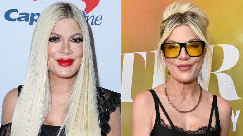 Side-by-side photos showing Tori Spelling's facial weight loss
