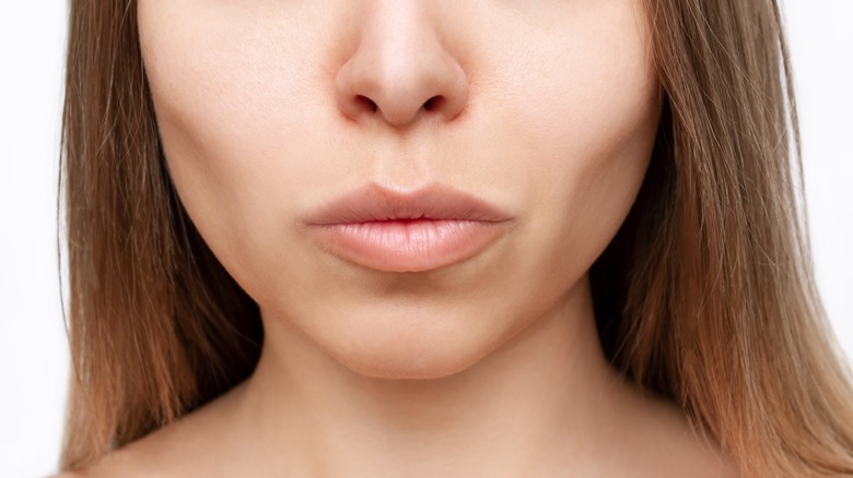 woman with buccal fat removal