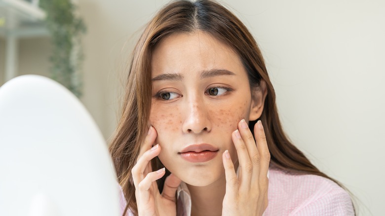 woman with sun spots