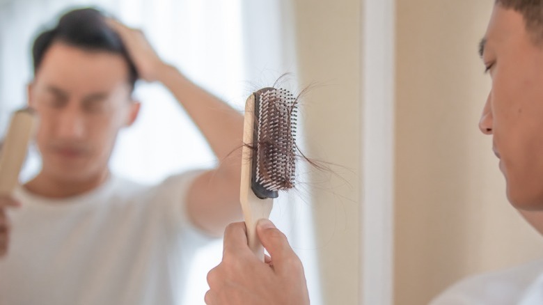 Man experiencing hair loss