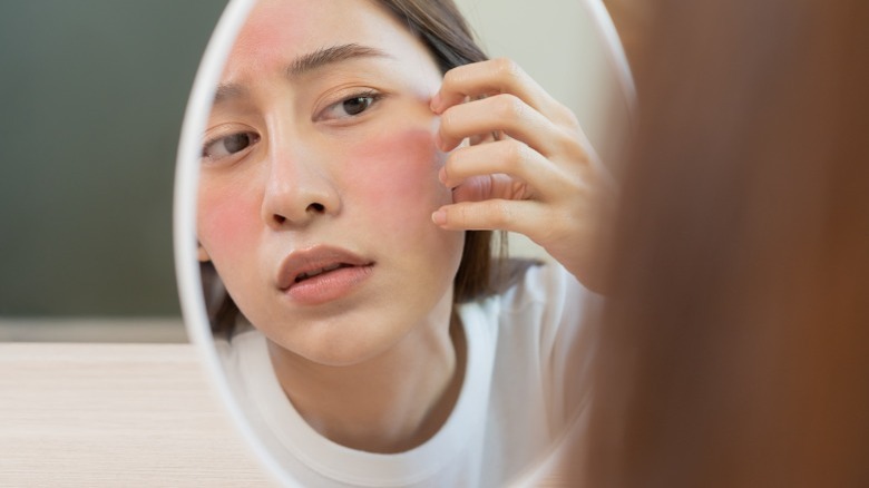 Woman with red face rash