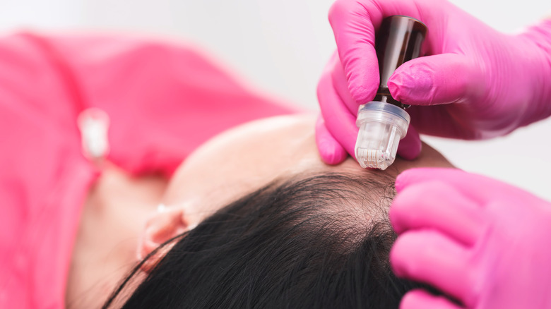 professional derma rolling 