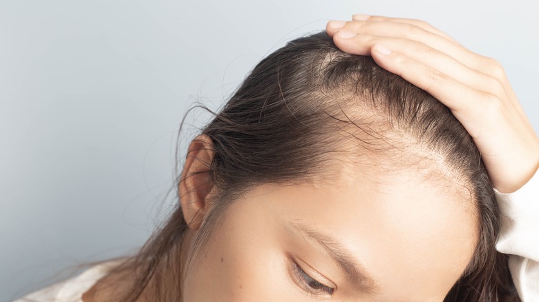 woman with thinning hair