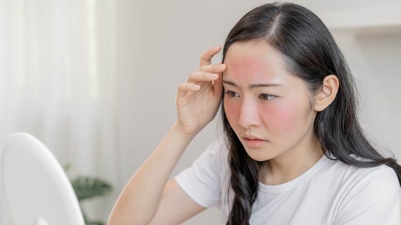 Woman with red, irritated skin
