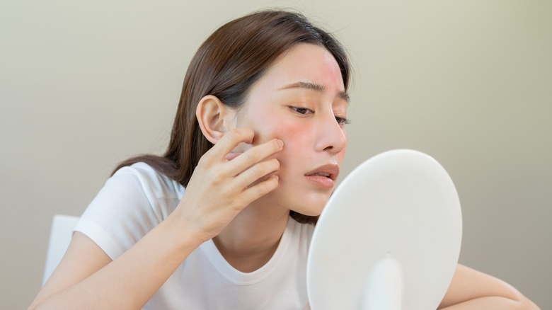 A woman experiencing skin redness