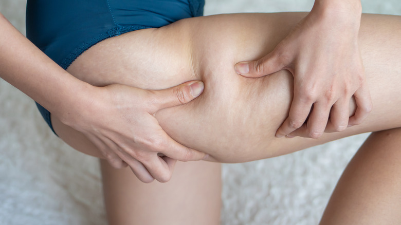 Woman with cellulite on thighs