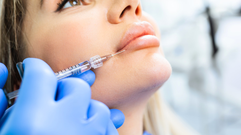 Woman hyaluronic acid lip filler