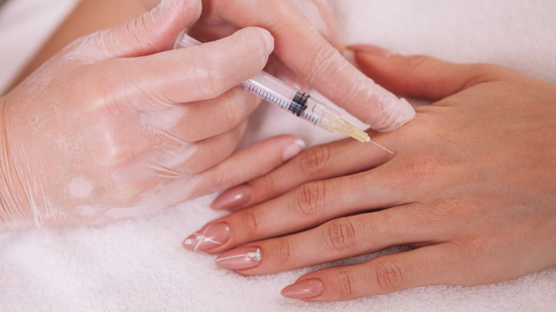 technician injecting hand with filler