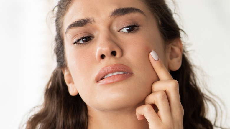 female having skin problem