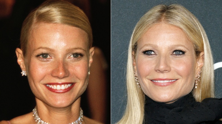 Gwyneth Paltrow before and after plastic surgery allegations