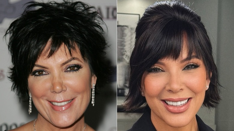 Kris Jenner in 2007 before plastic her first face lift surgery vs Kris Jenner in 2025 after face lift surgery