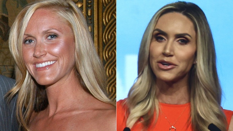 Lara Trump in 2008 before plastic surgery rumors vs Lara Trump in 2024 after plastic surgery rumors
