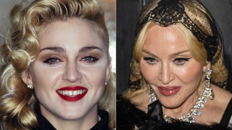 Madonna before and after plastic surgery looking very different