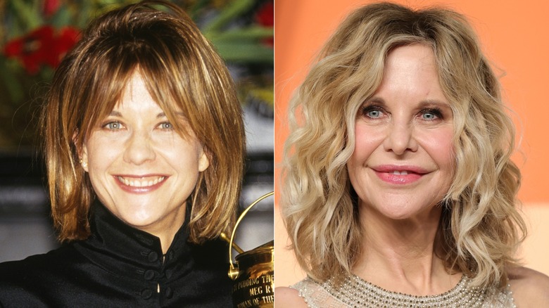 Meg Ryan before and after alleged plastic surgery transformation