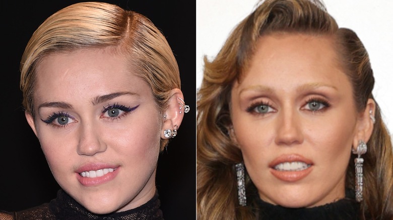 Miley Cyrus's face before and after what many people believe is buccal fat removal