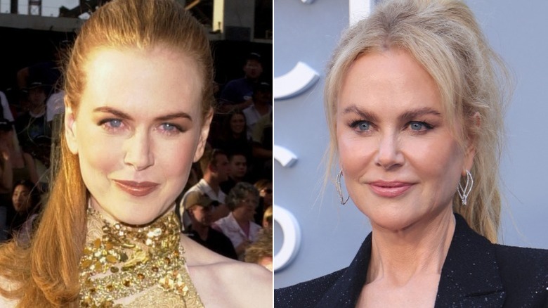Nicole Kidman wearing a gold dress in 2000 and wearing a black outfit in 2025