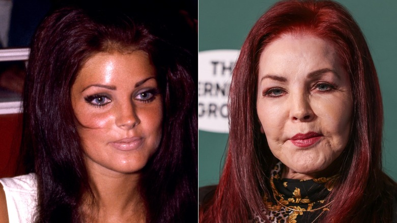Priscilla Presley before and after plastic surgery