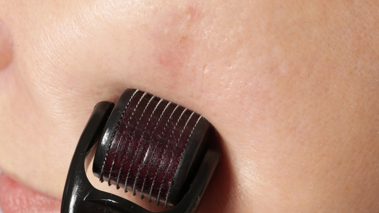 Person using a dermoroller