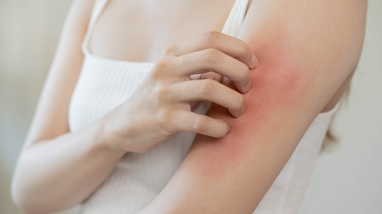 Girl scratches dry, red skin 