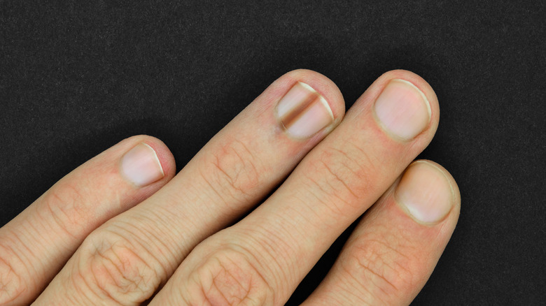 nail with a brown line on it