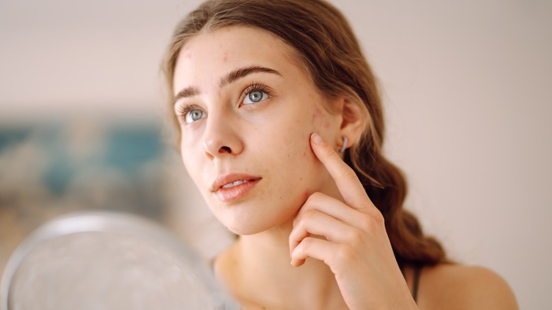 Woman with irritated skin pointing at her blemishes.