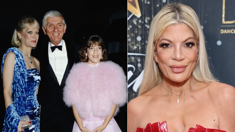 Tori Spelling before and after plastic surgery