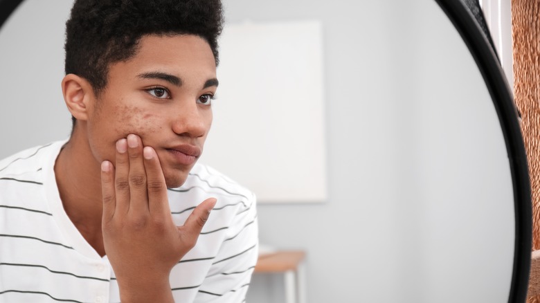 Man looking at acne in mirror 