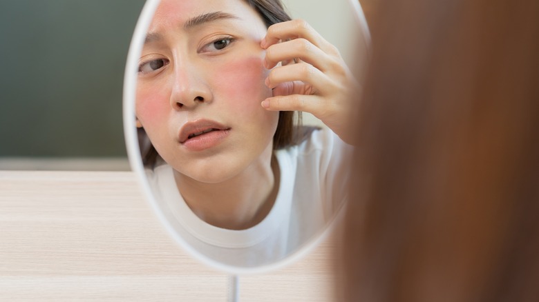 red areas on woman's face