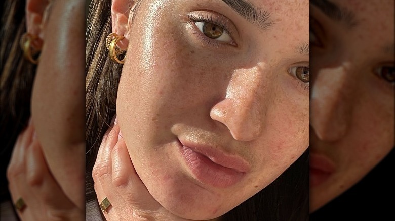 woman with freckles