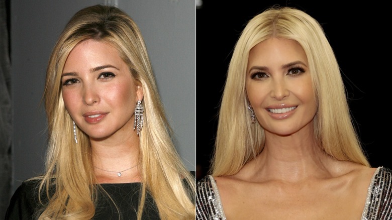 Ivanka Trump before and after her face transformation
