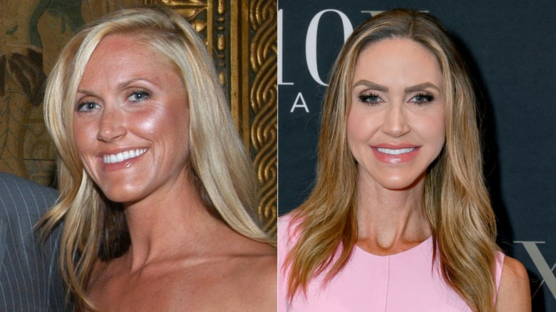 Lara Trump before and after her face transformation