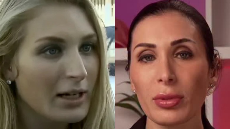 Laura Loomer before and after her MAGA face transformation