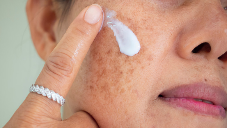 woman applying cream on melasma