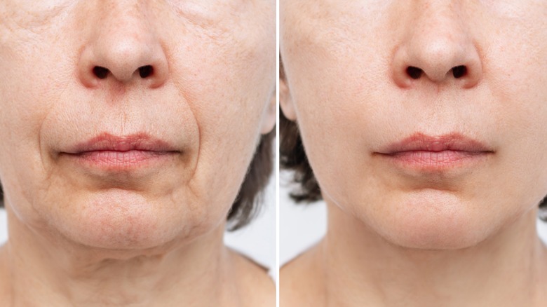 skin before after treatment