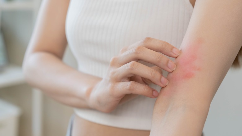 Woman scratching dry, irritated skin