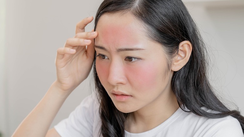 Woman with irritated skin.