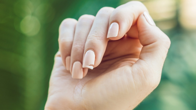 A hand with a broken nail.
