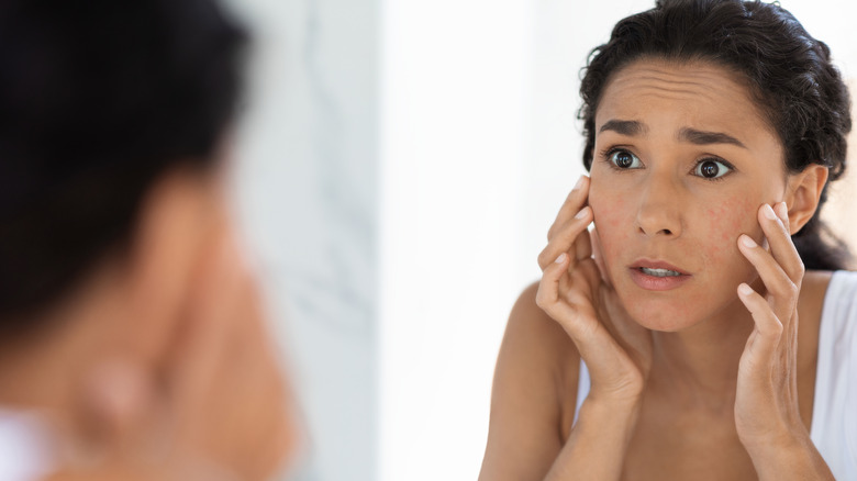 shocked woman looking at acne